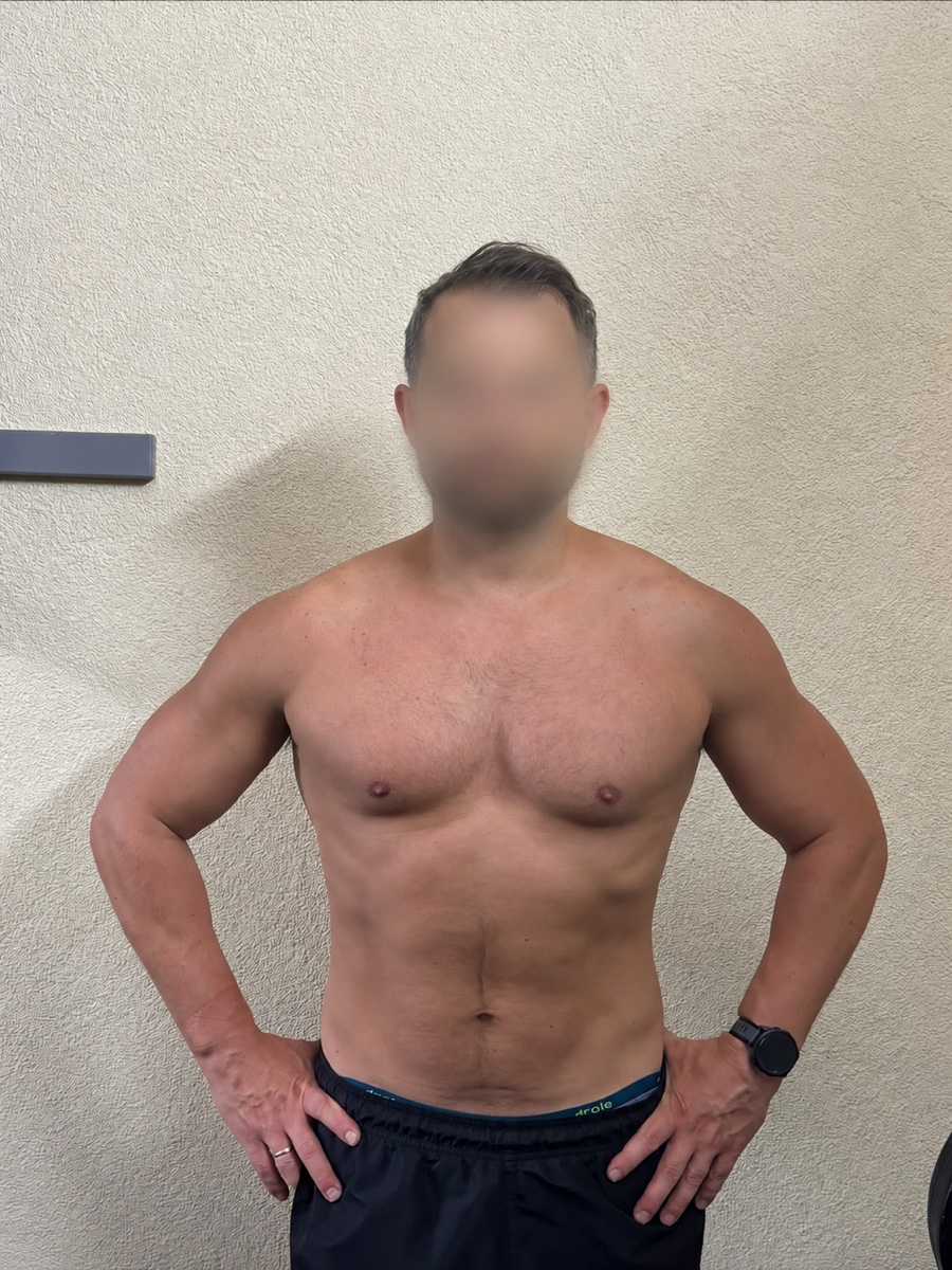 Client transformation — After