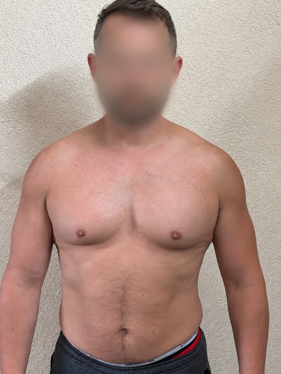 Client transformation — Before